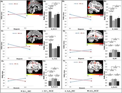 Effects of DISC1 Polymorphisms on Resting-State Spontaneous Neuronal Activity in the Early-Stage of Schizophrenia